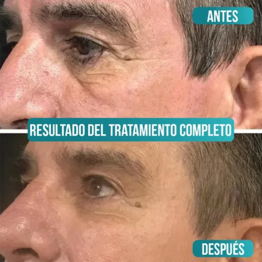 Veze Men | Crema Anti Edad de Colageno
